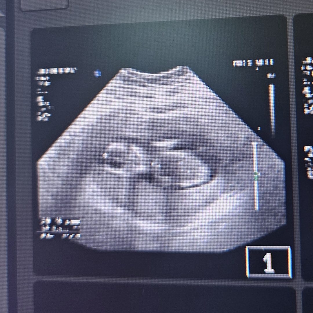 Photo shared by Whitley for their Babylist baby registry.