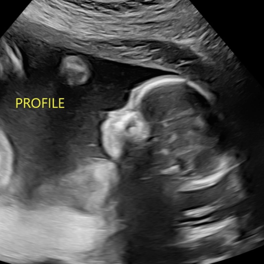 Photo shared by Danica for their Babylist baby registry.