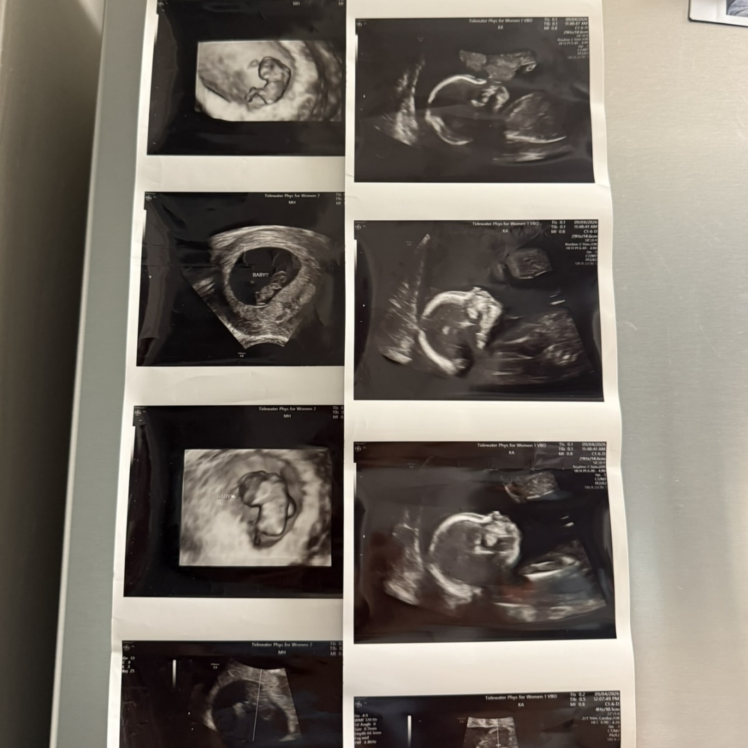 Photo shared by Paul for their Babylist baby registry.
