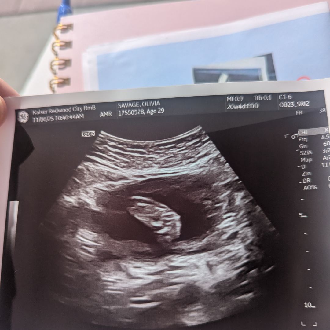 Photo shared by Olivia for their Babylist baby registry.