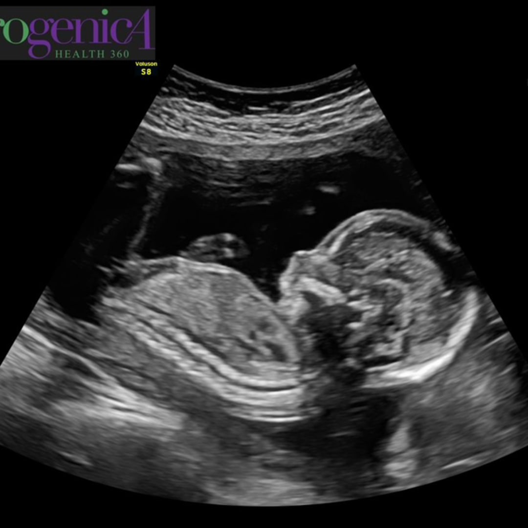 Photo shared by Lila for their Babylist baby registry.