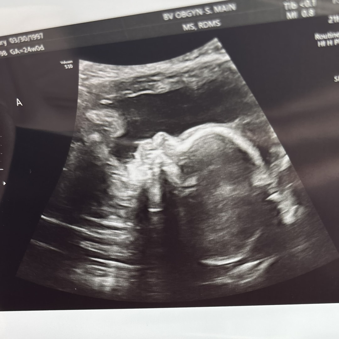 Photo shared by Abbey for their Babylist baby registry.