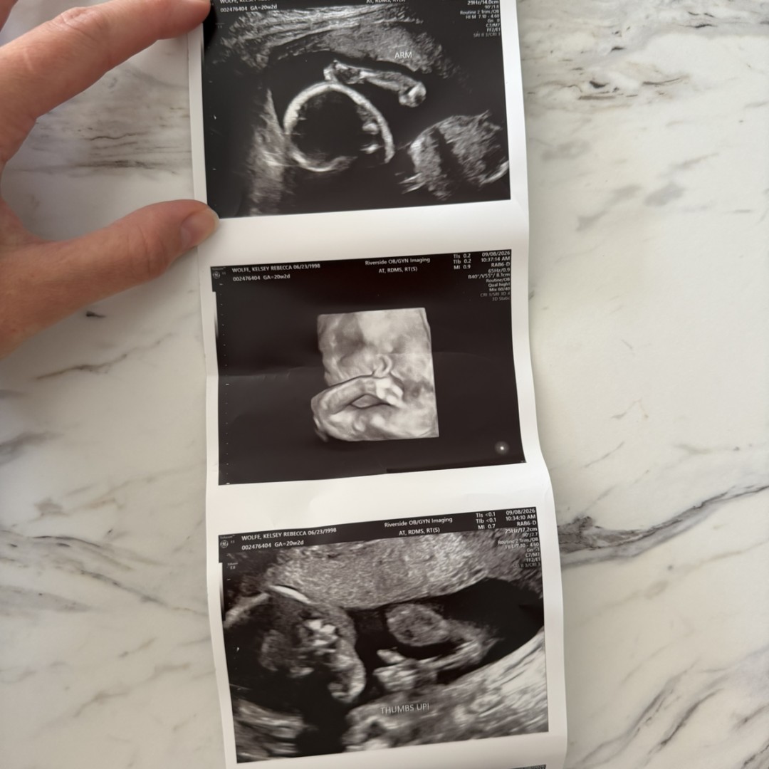 Photo shared by Kelsey for their Babylist baby registry.