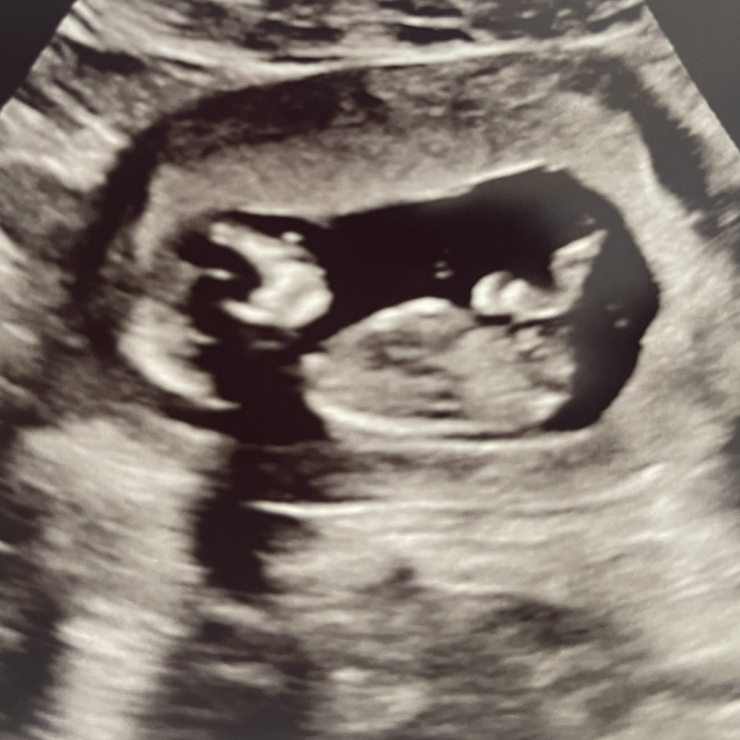 Photo shared by Tyra for their Babylist baby registry.