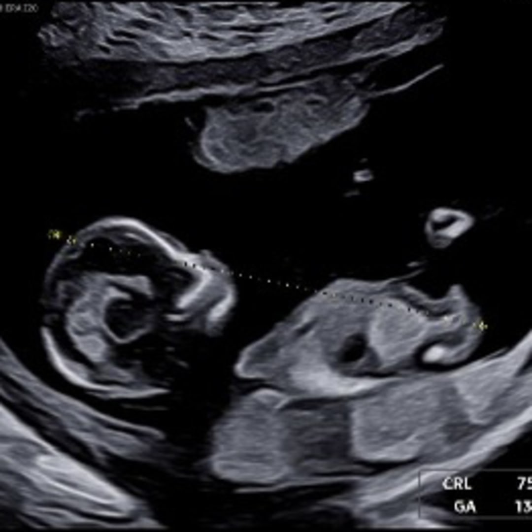 Photo shared by Stephanie for their Babylist baby registry.