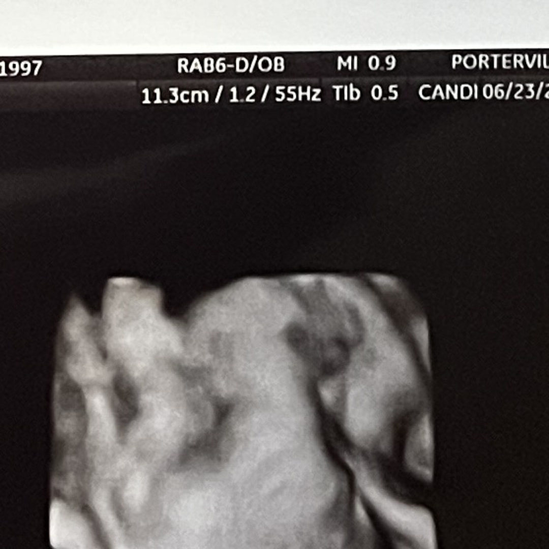 Photo shared by Alisha for their Babylist baby registry.