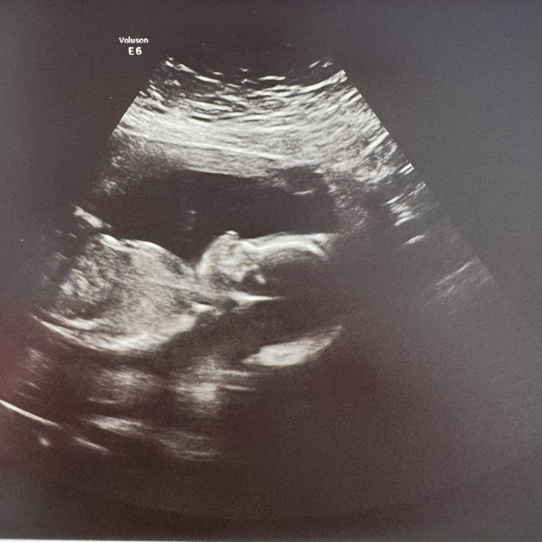 Photo shared by Emily for their Babylist baby registry.