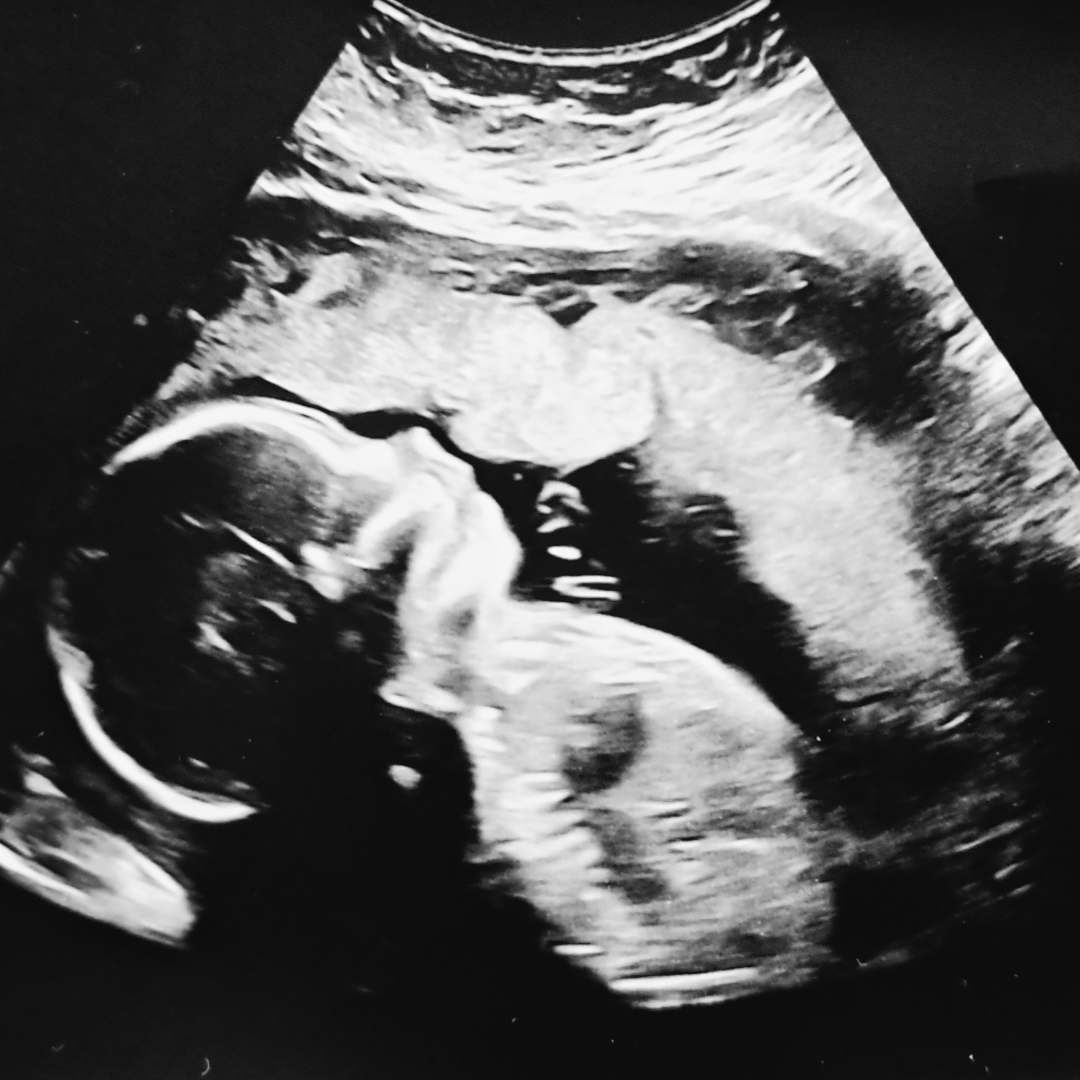 Photo shared by Laura for their Babylist baby registry.