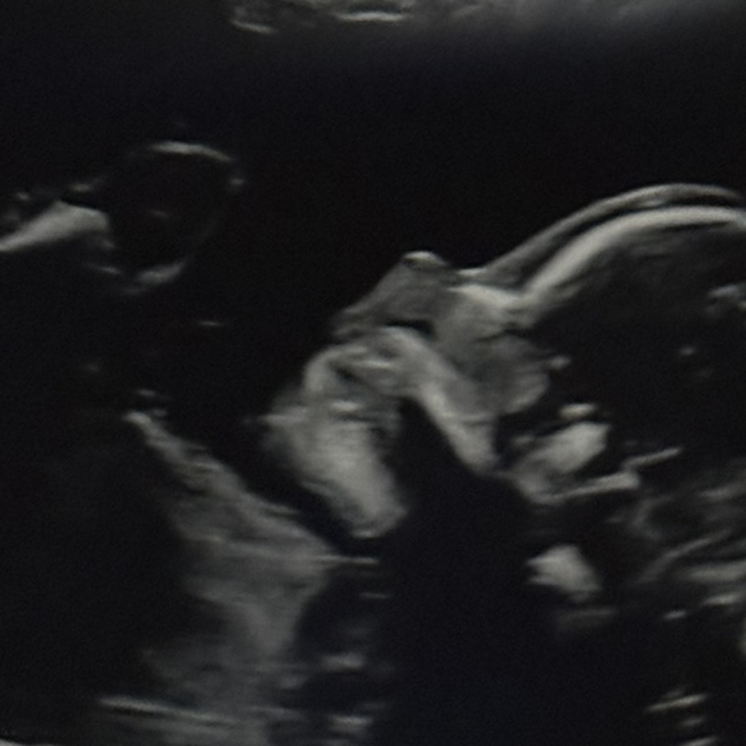 Photo shared by Olivia for their Babylist baby registry.