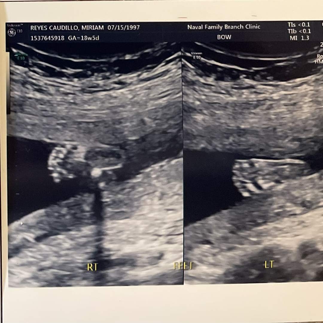 Photo shared by Miriam for their Babylist baby registry.