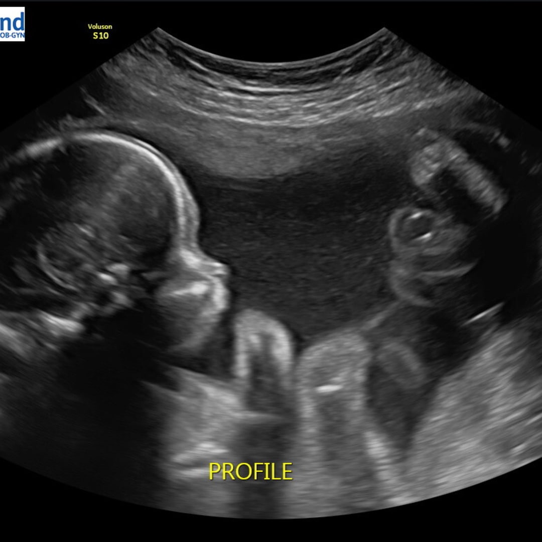 Photo shared by Morgan for their Babylist baby registry.