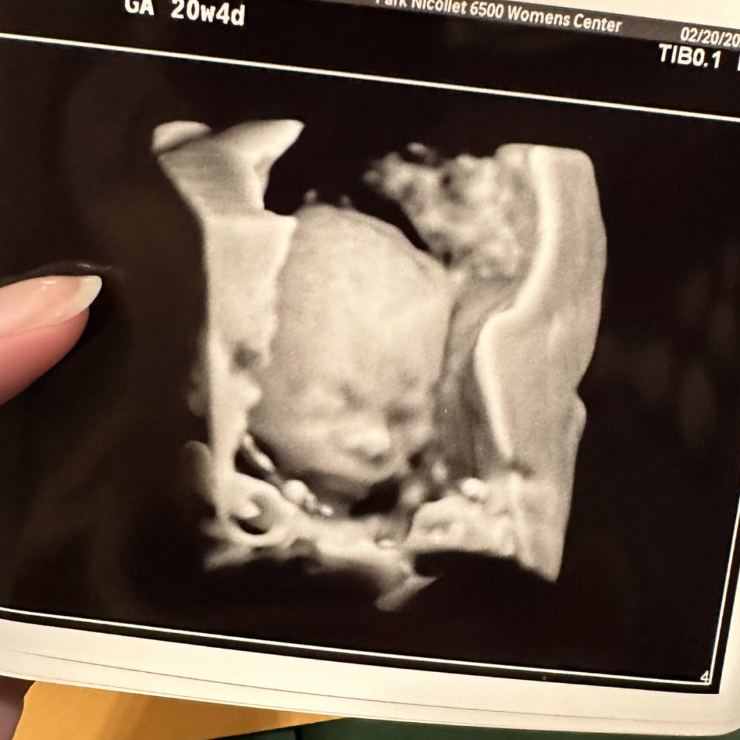 Photo shared by Cassidy for their Babylist baby registry.