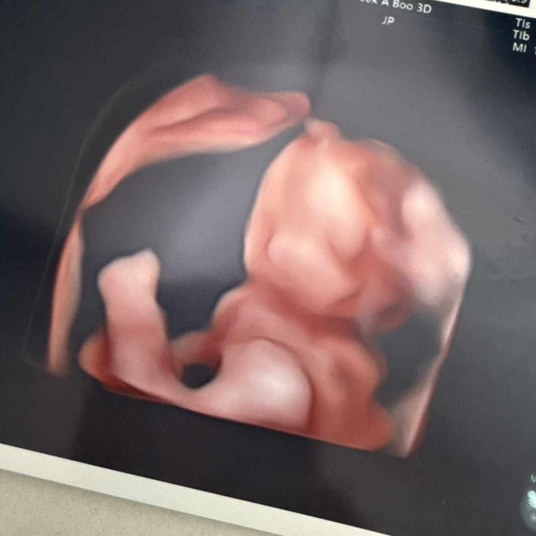 Photo shared by Stephanie for their Babylist baby registry.