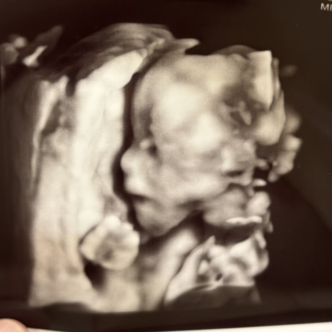 Photo shared by Madelyn for their Babylist baby registry.