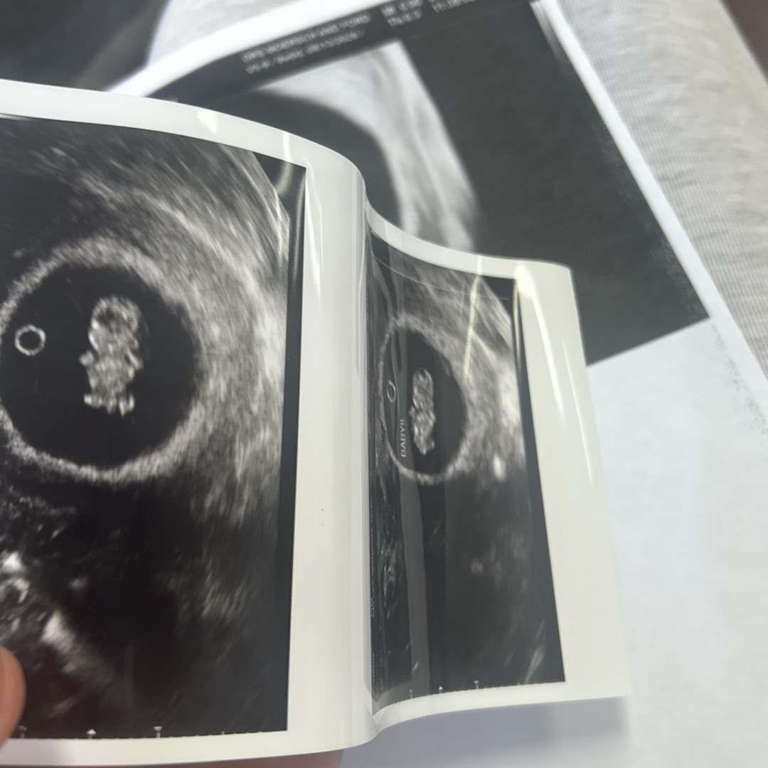 Photo shared by Sedricka for their Babylist baby registry.