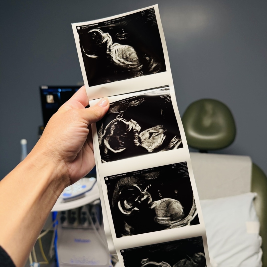 Photo shared by Callie for their Babylist baby registry.