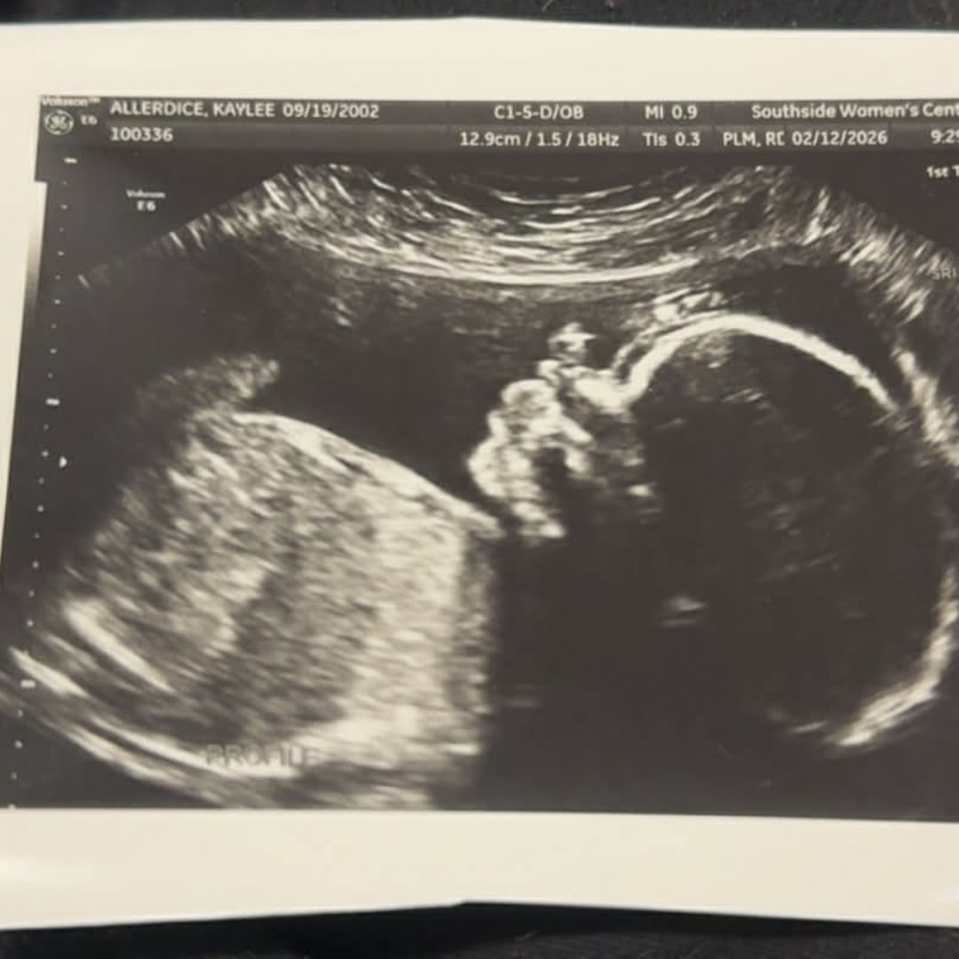 Photo shared by Lee for their Babylist baby registry.