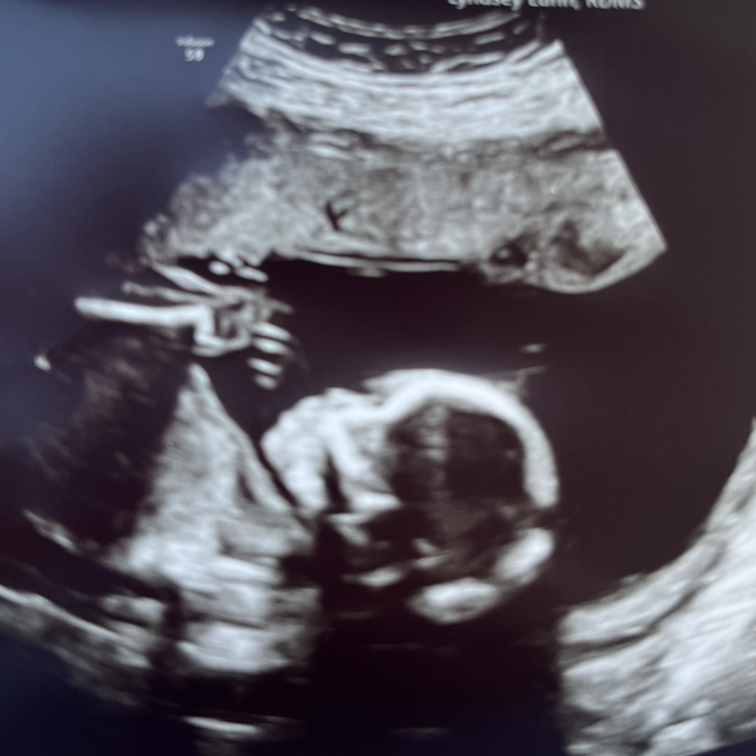 Photo shared by Jessica for their Babylist baby registry.