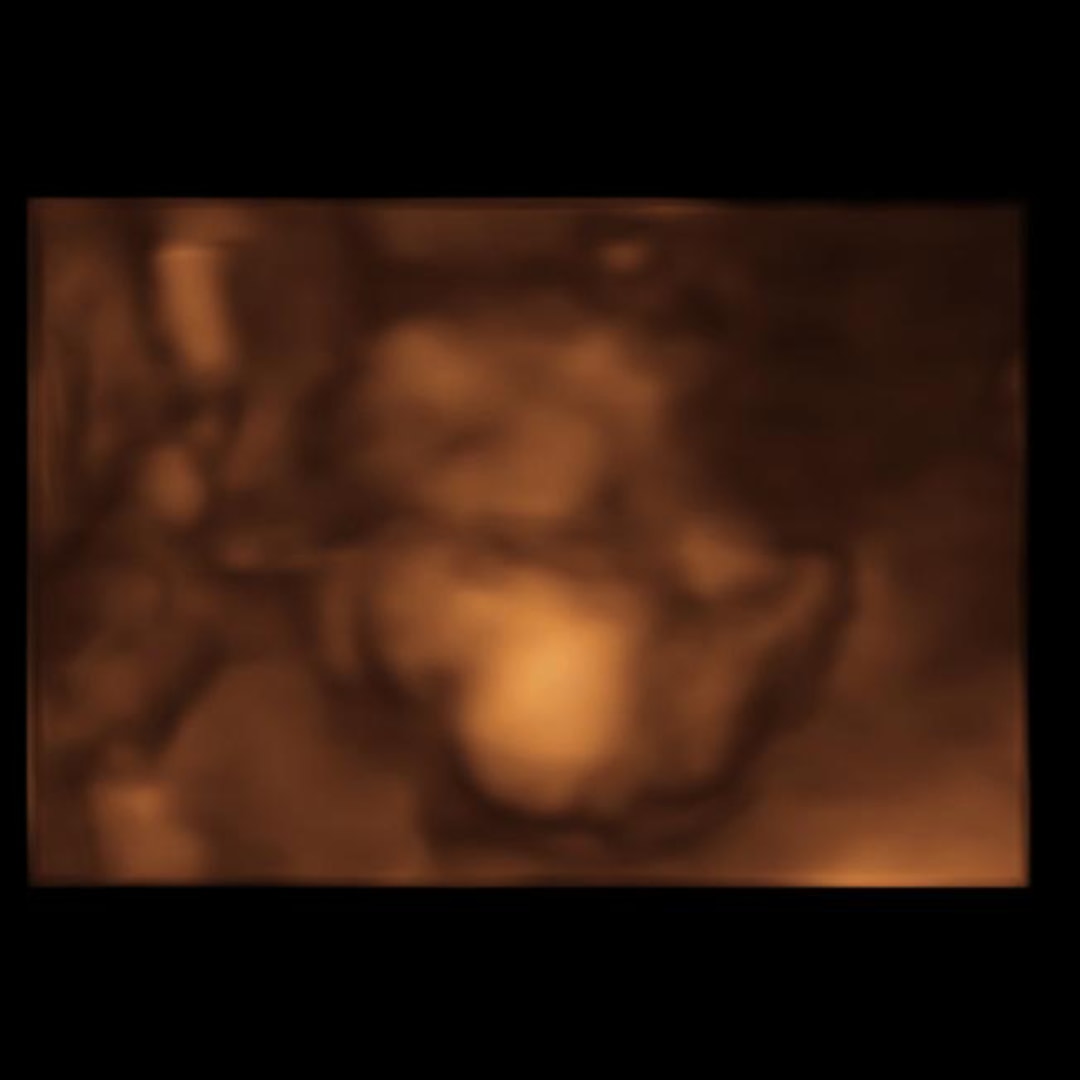 Photo shared by Aleeya for their Babylist baby registry.