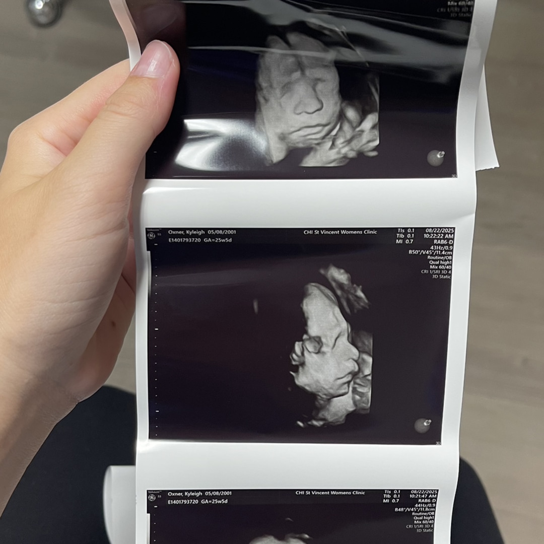 Photo shared by Kyleigh for their Babylist baby registry.