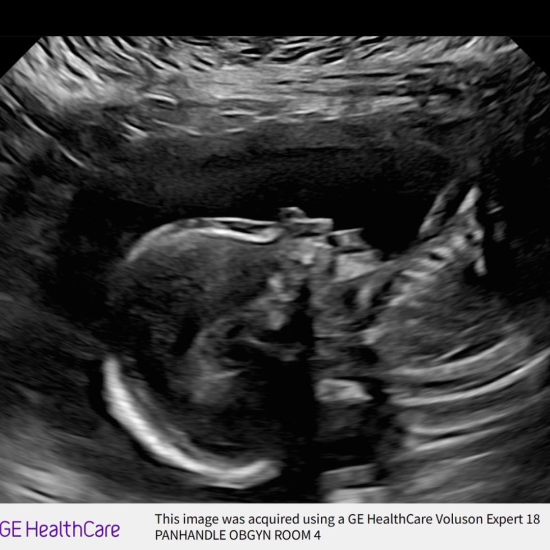 Photo shared by Morgan for their Babylist baby registry.
