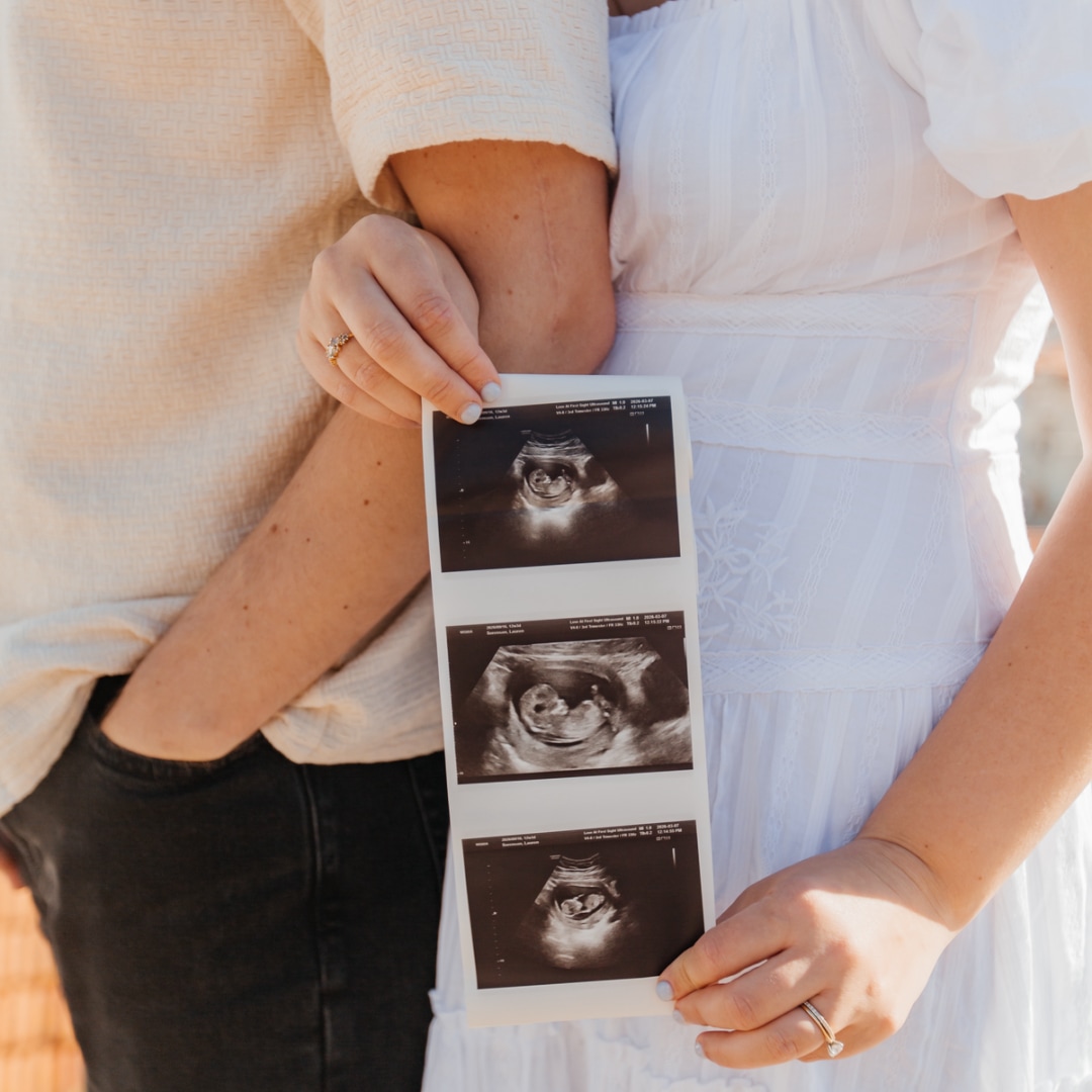 Photo shared by Lauren for their Babylist baby registry.