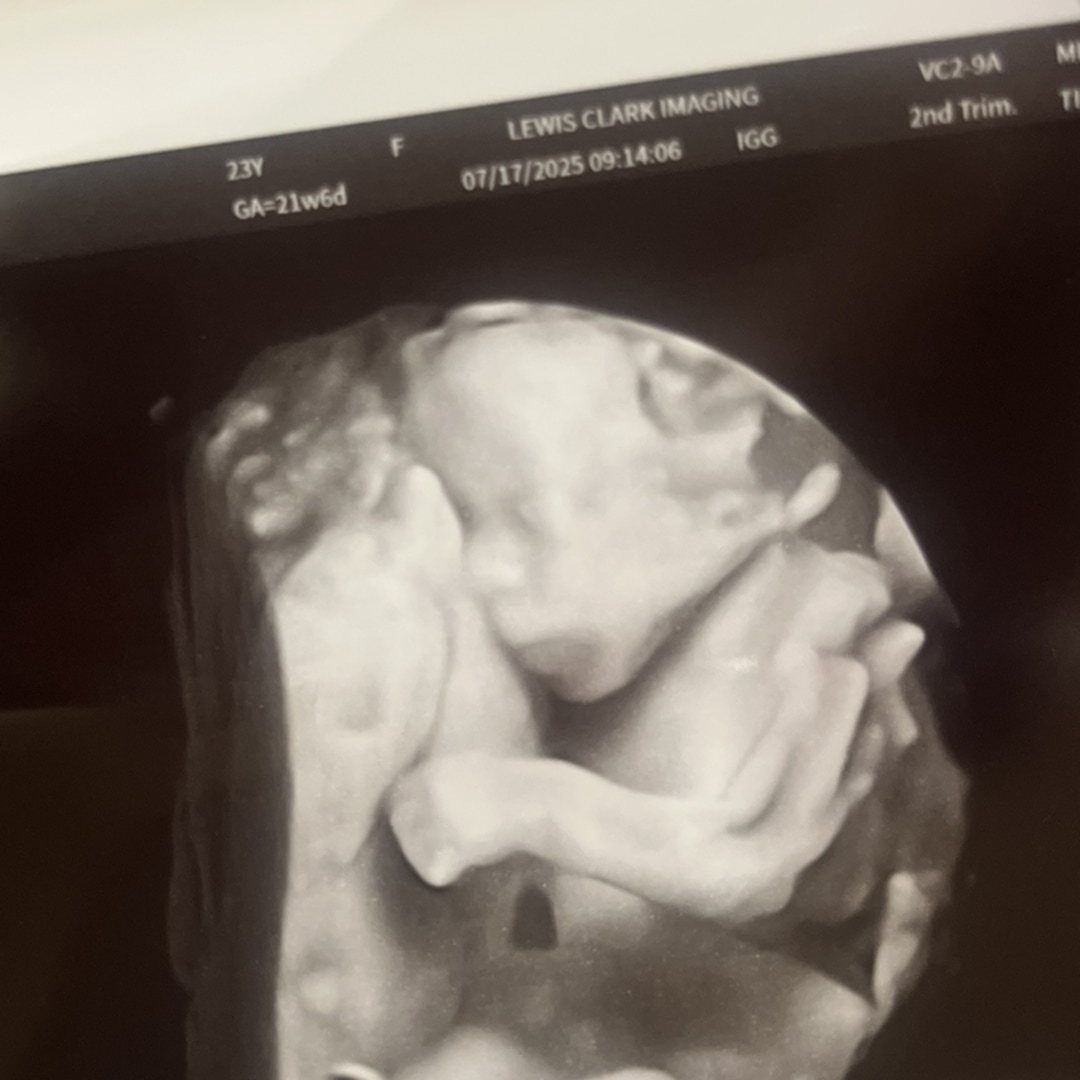 Photo shared by Anna for their Babylist baby registry.
