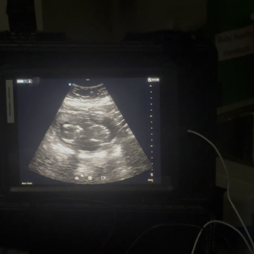 Photo shared by Aleena for their Babylist baby registry.