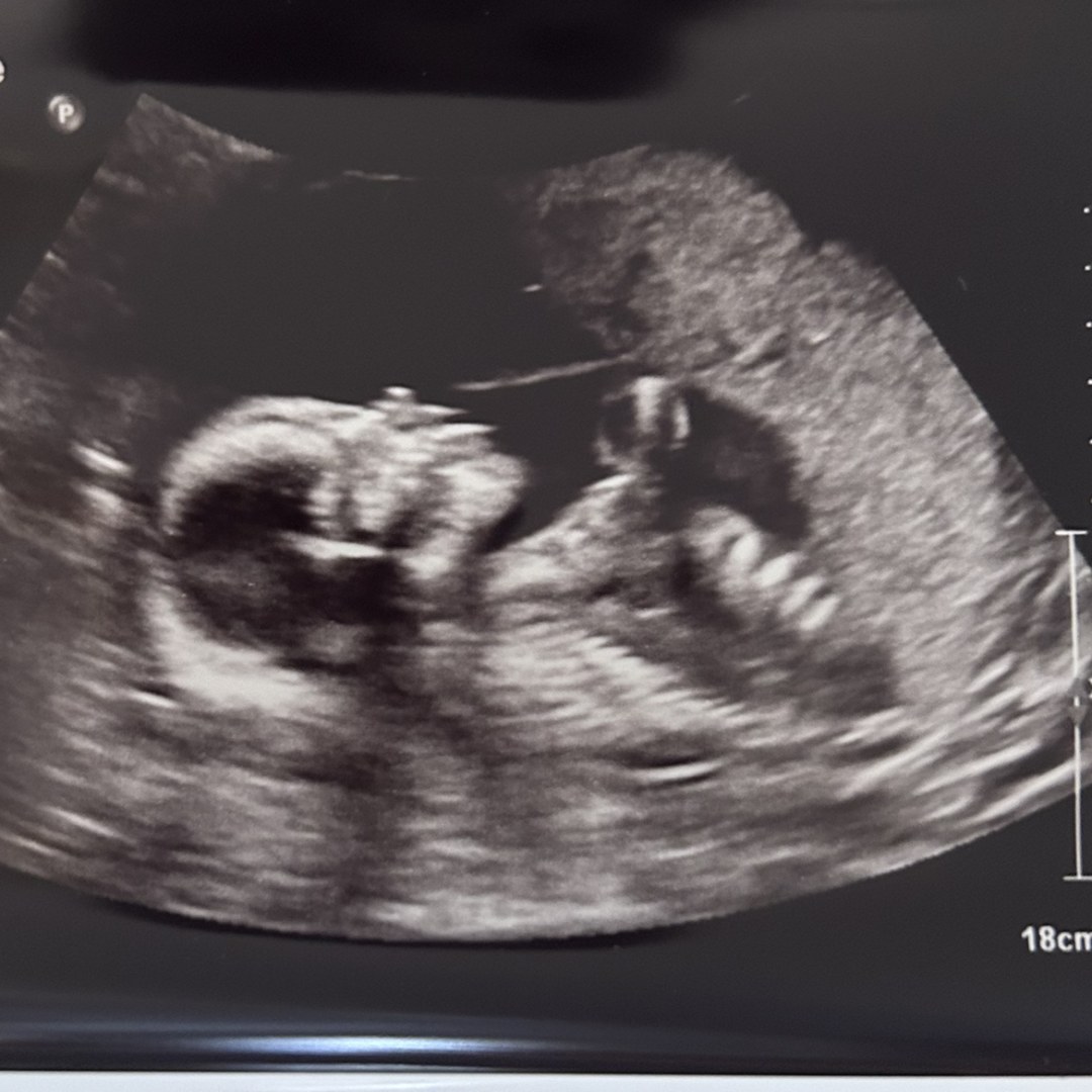 Photo shared by Ashley for their Babylist baby registry.