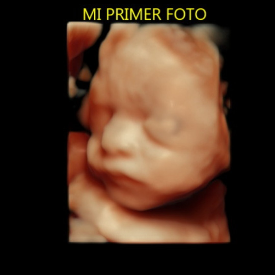 Photo shared by Alexis for their Babylist baby registry.