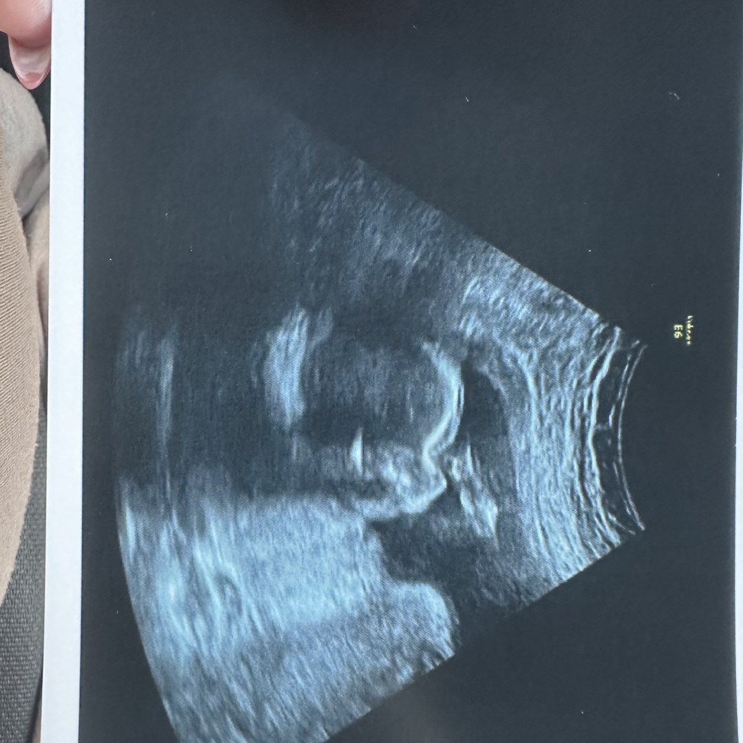 Photo shared by Sara for their Babylist baby registry.