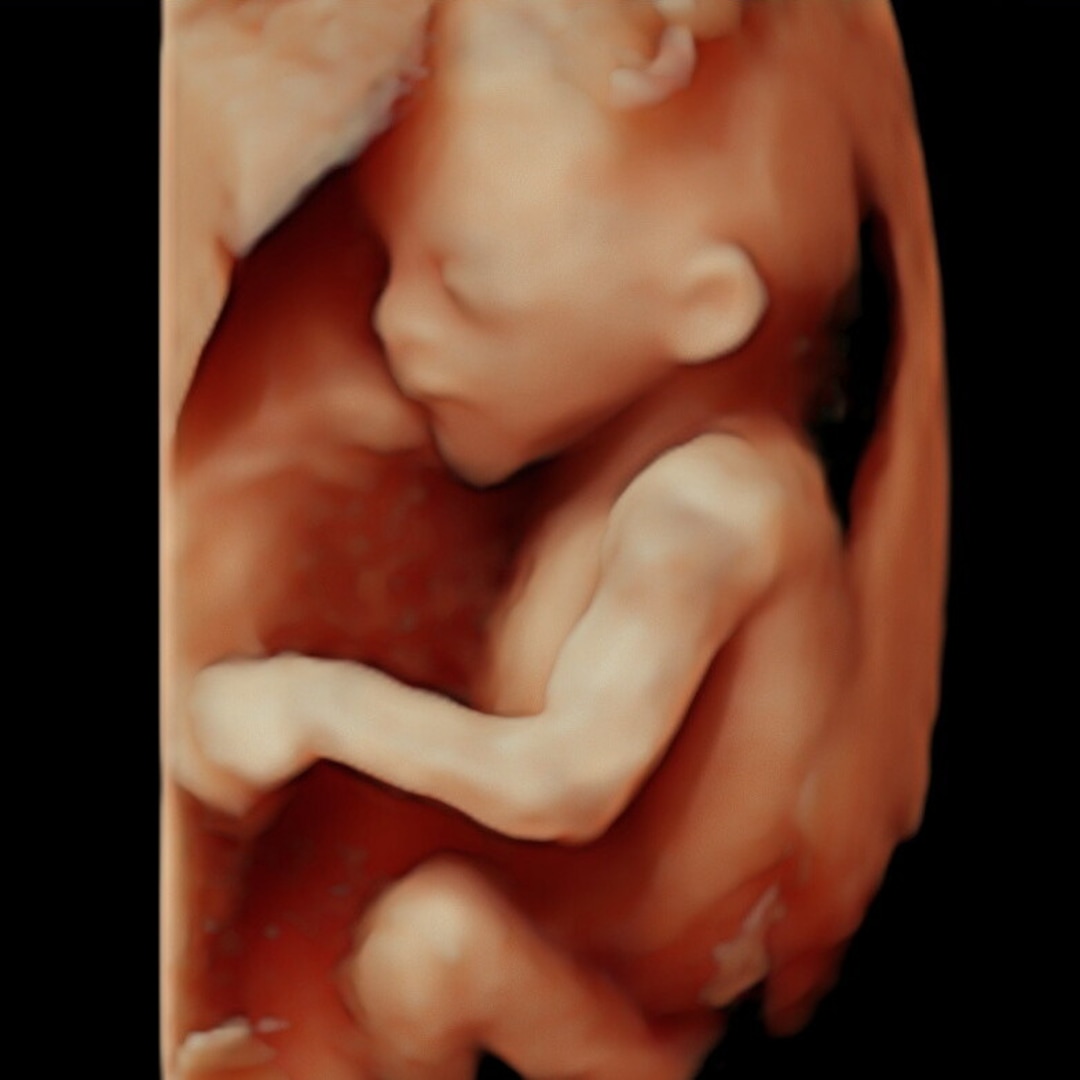 Photo shared by Tiffany for their Babylist baby registry.