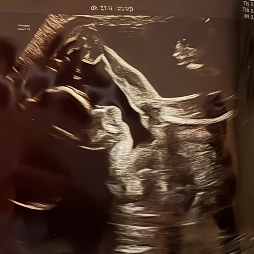 Photo shared by Hannah for their Babylist baby registry.