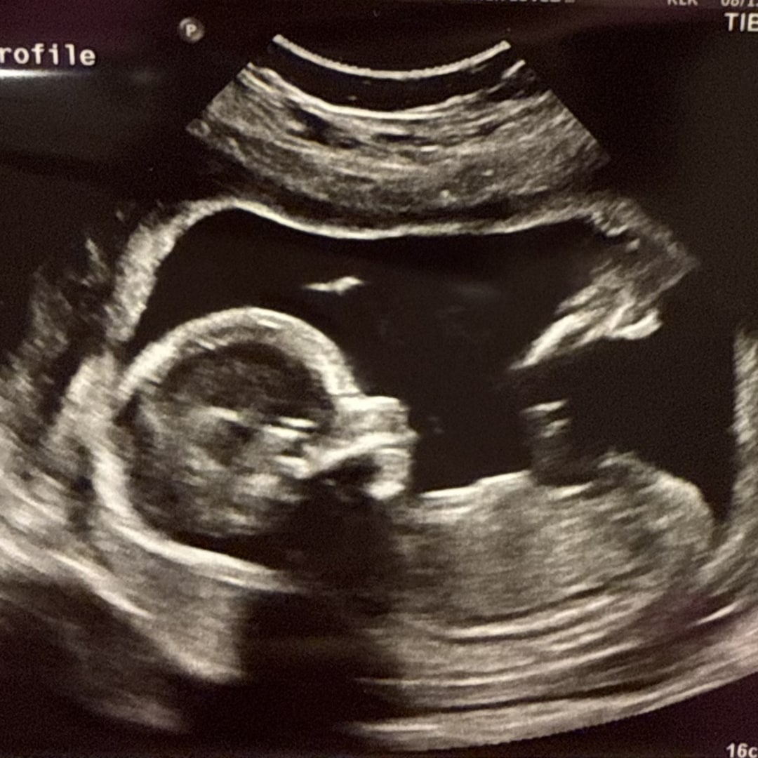 Photo shared by Chloe for their Babylist baby registry.