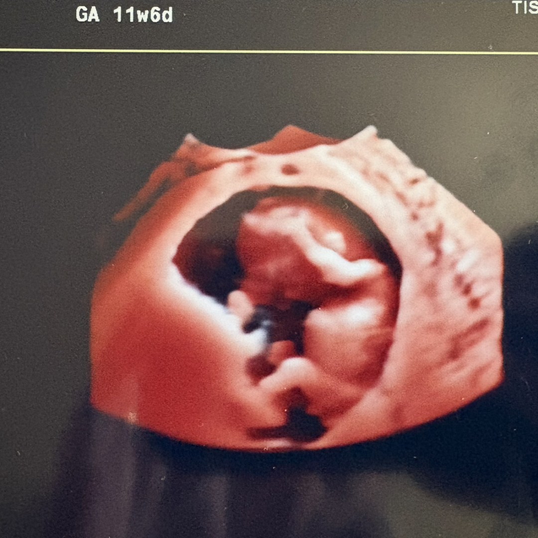 Photo shared by Ivy for their Babylist baby registry.