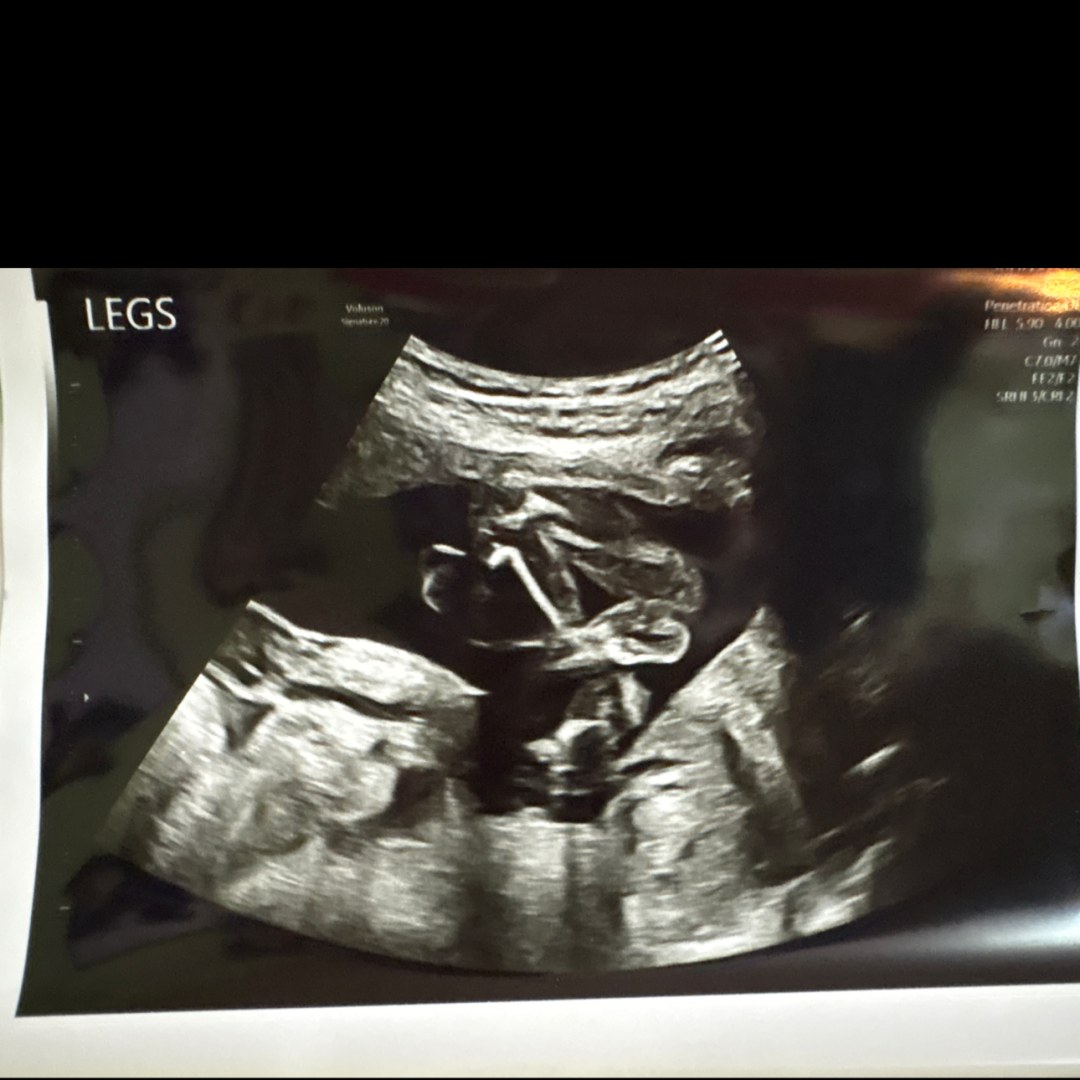 Photo shared by Savannah for their Babylist baby registry.