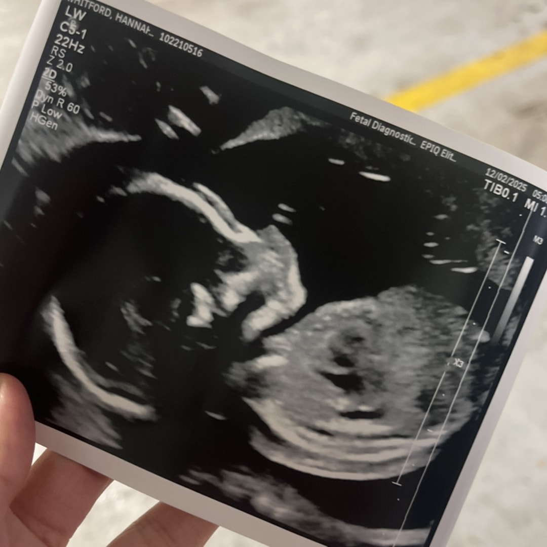 Photo shared by Hannah for their Babylist baby registry.