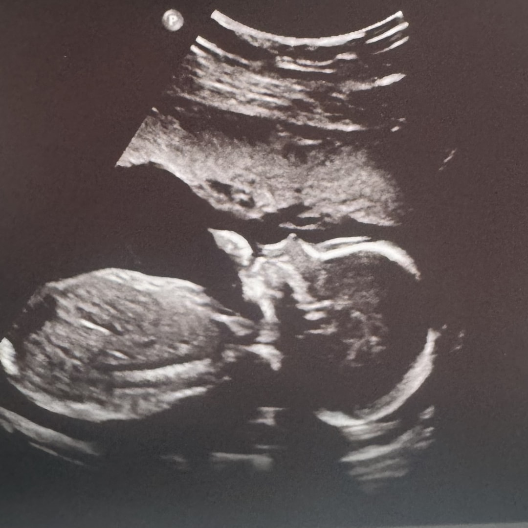 Photo shared by Katie for their Babylist baby registry.