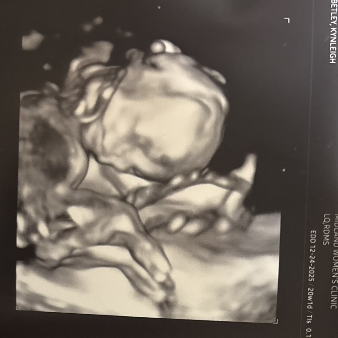 Photo shared by Kynleigh for their Babylist baby registry.