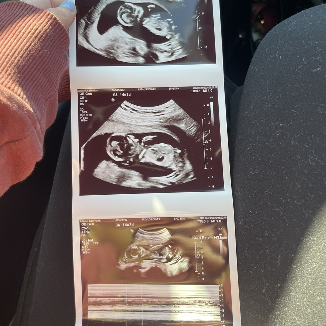 Photo shared by Kailey Ann for their Babylist baby registry.