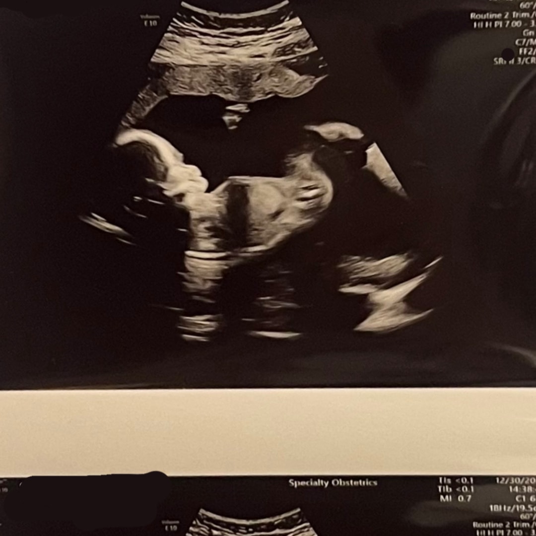 Photo shared by Jaden for their Babylist baby registry.