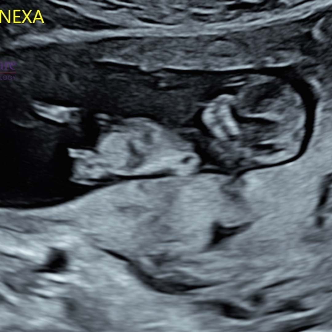 Photo shared by Jaime for their Babylist baby registry.