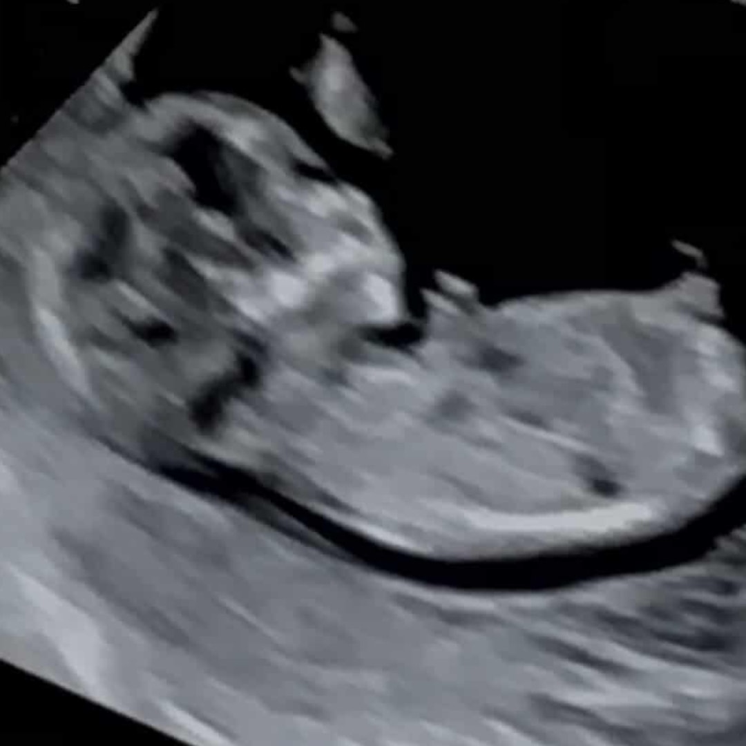 Photo shared by Liana for their Babylist baby registry.