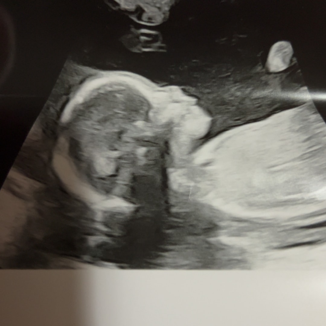 Photo shared by Katelyn for their Babylist baby registry.