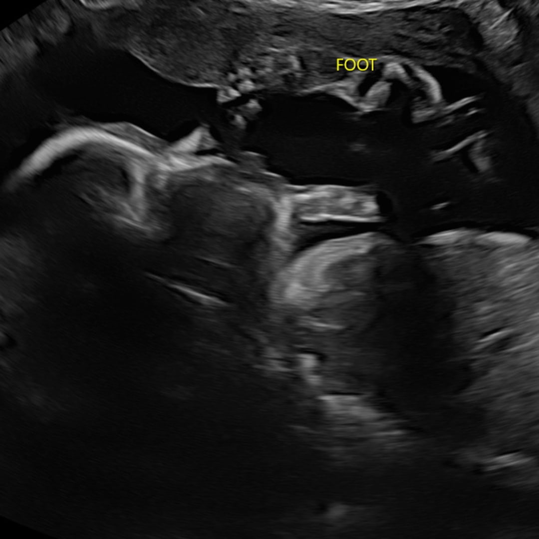 Photo shared by Taylor for their Babylist baby registry.