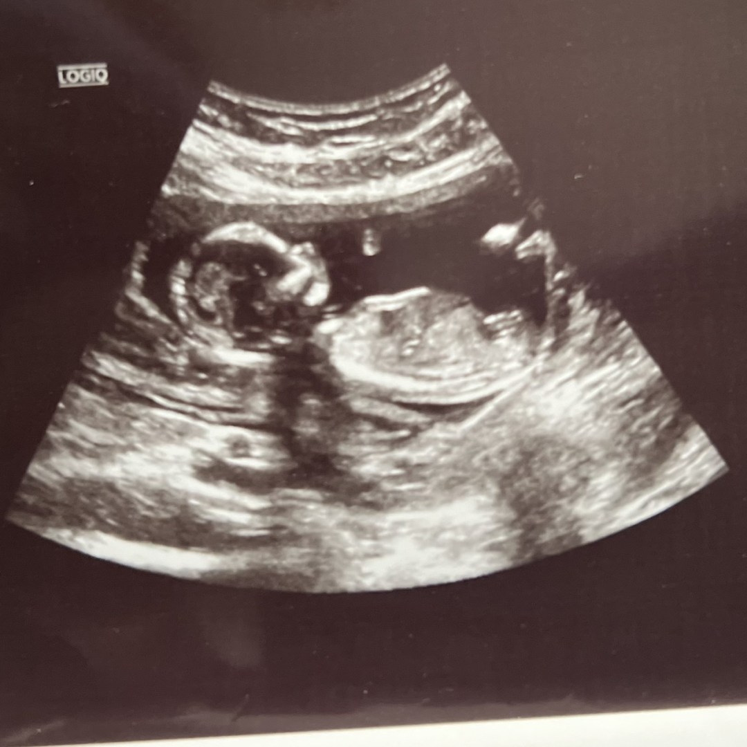 Photo shared by Anna for their Babylist baby registry.