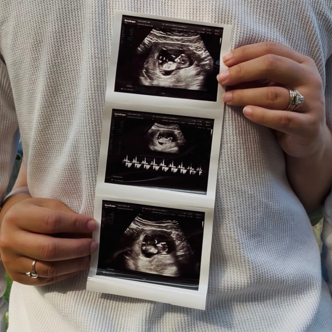 Photo shared by Rebecca for their Babylist baby registry.