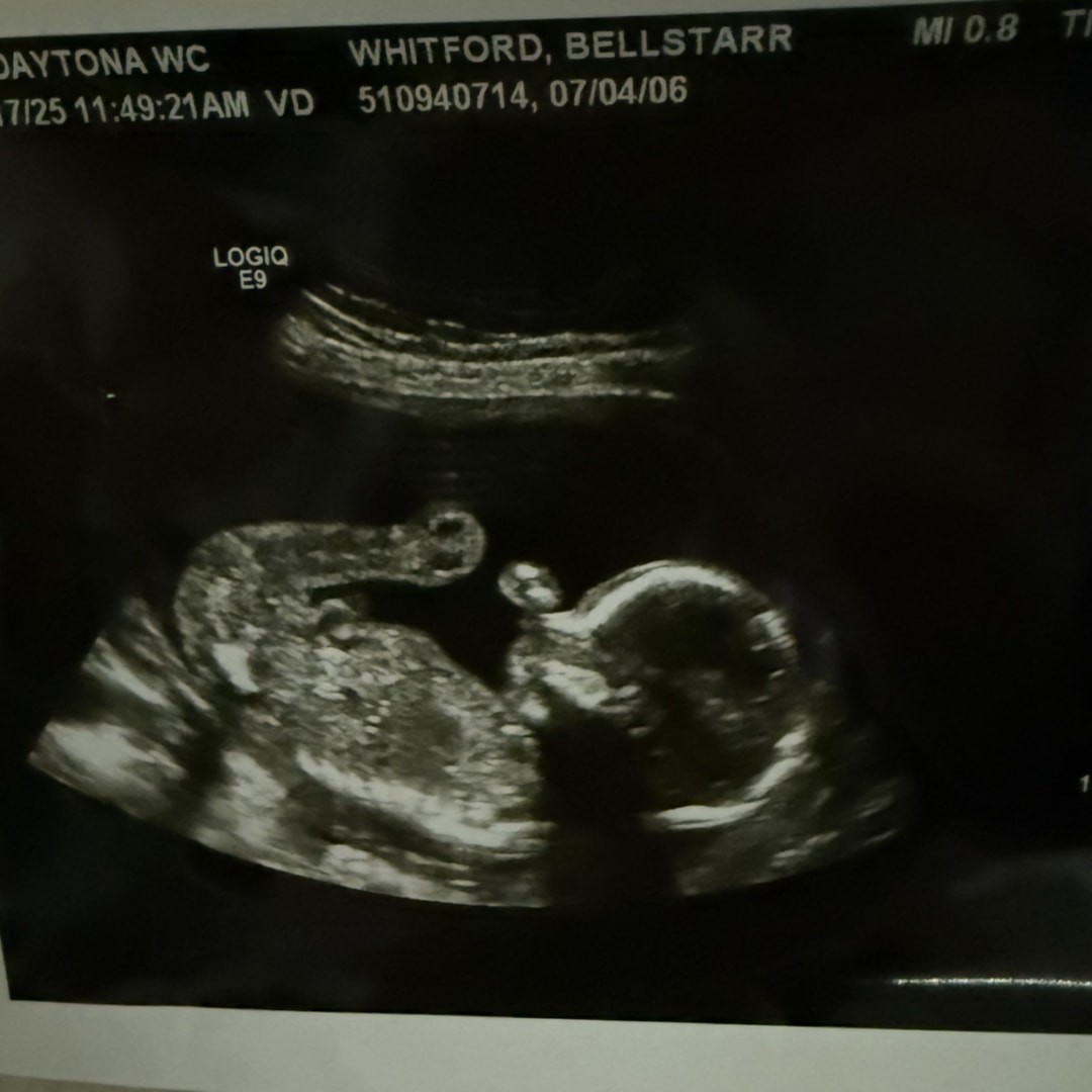 Photo shared by Bellstarr for their Babylist baby registry.