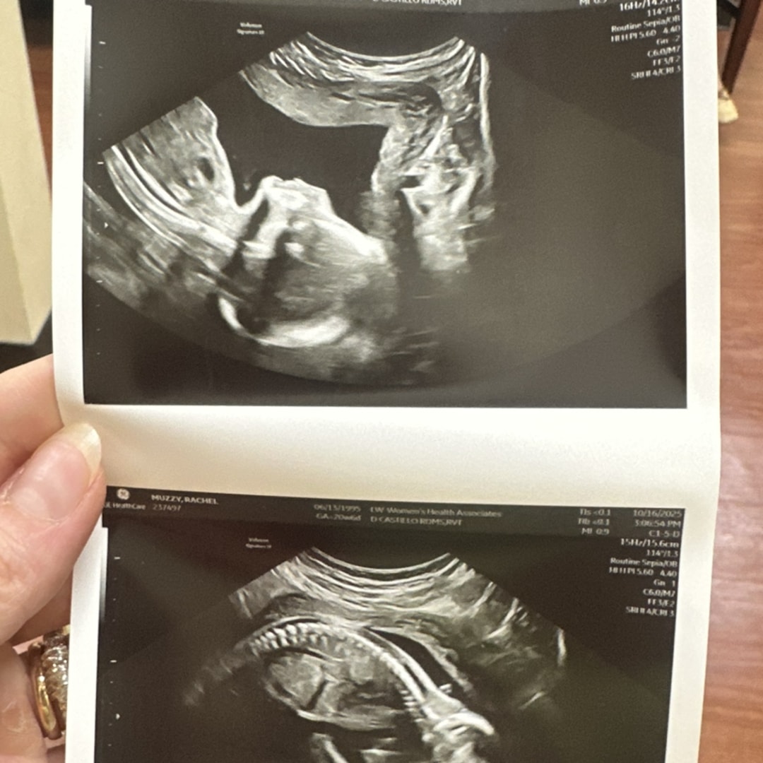 Photo shared by Rachel for their Babylist baby registry.