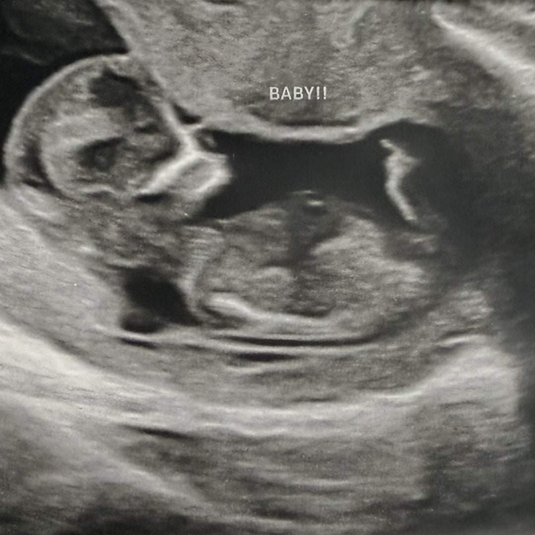 Photo shared by Dayna for their Babylist baby registry.